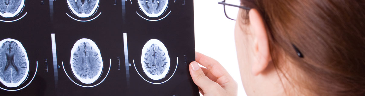 Brain injury attorney in Las Vegas